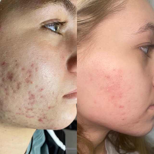 Kri-Zia’s Skin Reset Program at Krizia’s Skin Care & Lashes in Winter Haven, FL